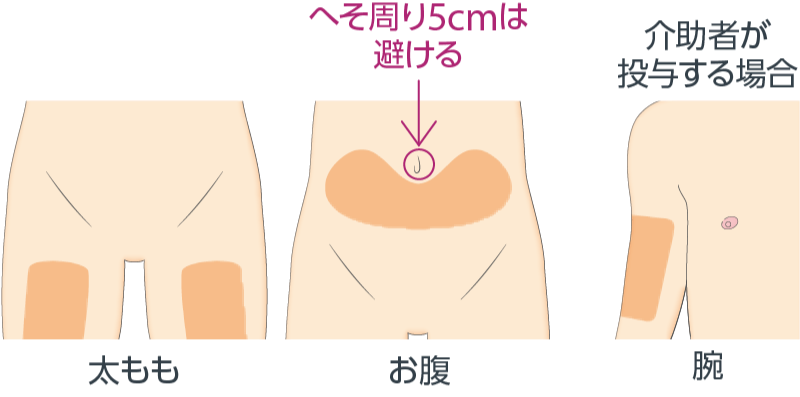 注射する部位を確認します