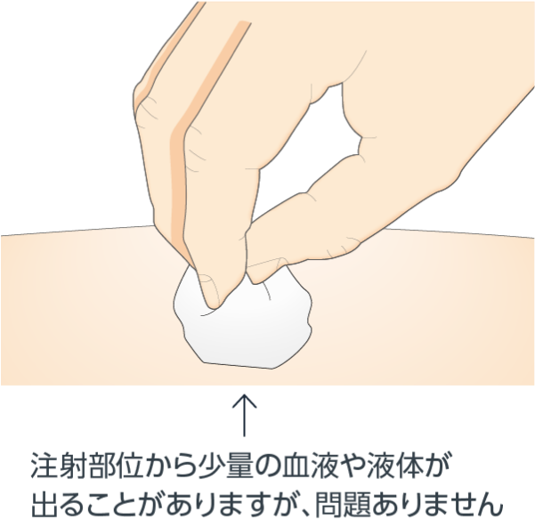 注射部位を確認します