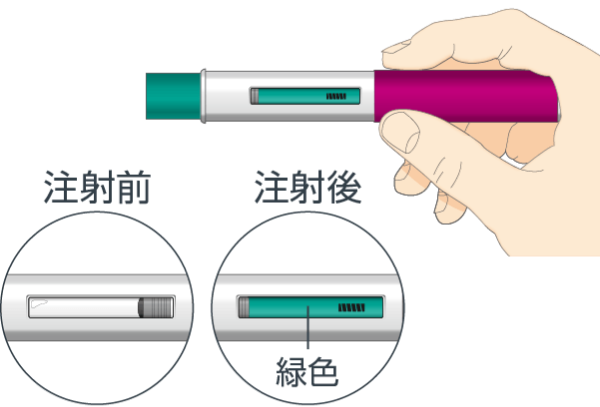 確認窓を確認します