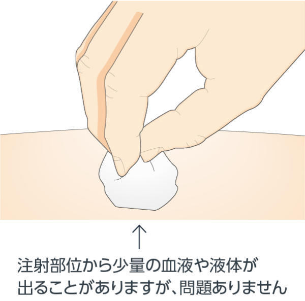 注射部位を確認します