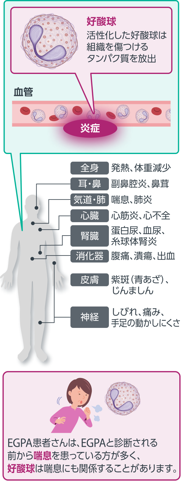 EGPAと好酸球3-5)