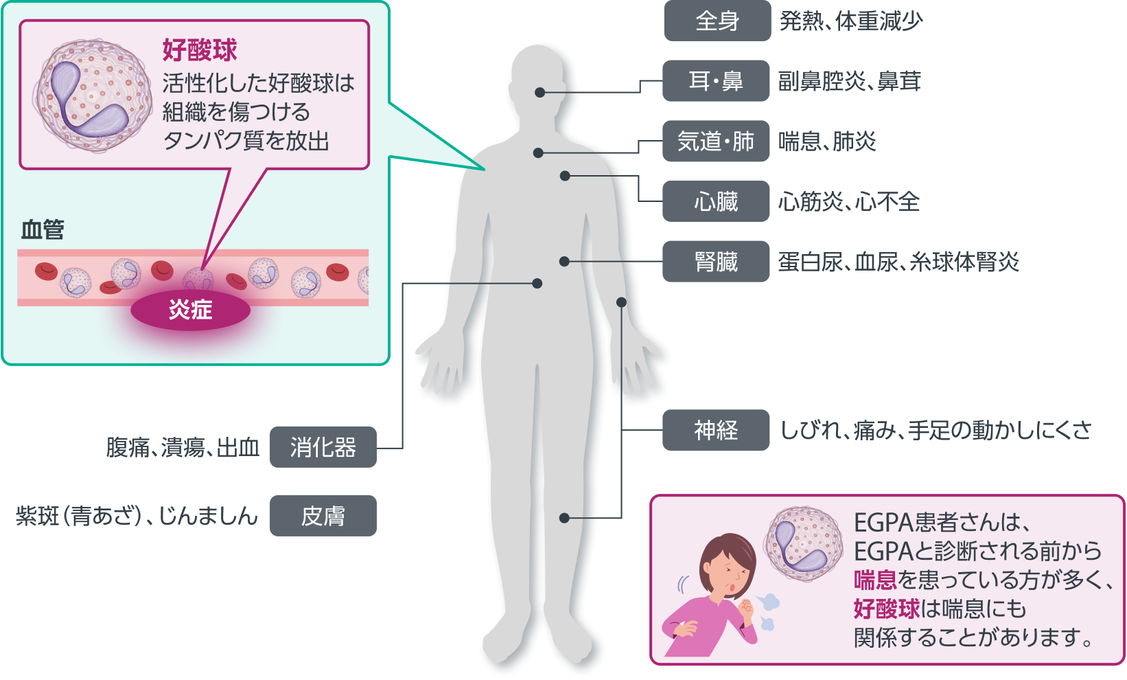 EGPAと好酸球3-5)