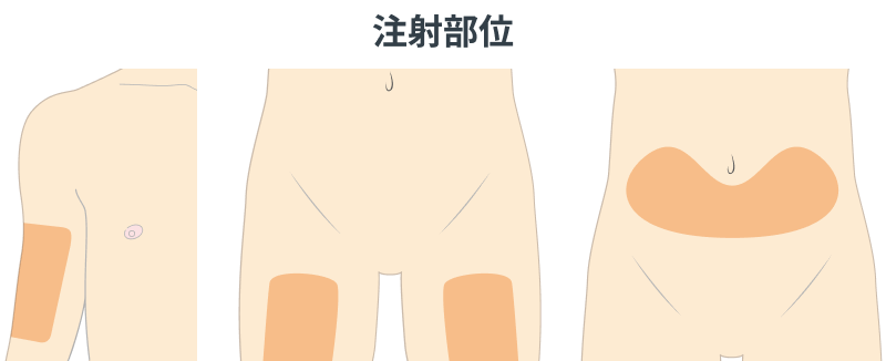 画像 注射方法